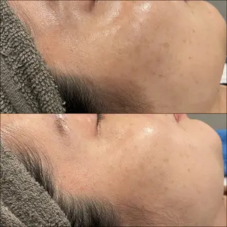 LiZA エステティックサロンのエステ・リラクイメージ