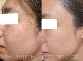 肌質改善美容サロン ému 用賀のエステ・リラクイメージ