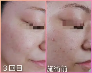 N. pauleleのマツエク・マツパデザイン