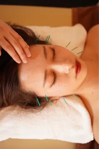 美容鍼・鍼灸専門❤✨ 近藤めぐみのエステ・リラクイメージ