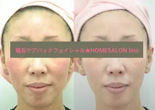 HOME SALON linoのエステ・リラクイメージ