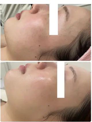 美乳バストサロン RAYVIS💍のエステ・リラクイメージ