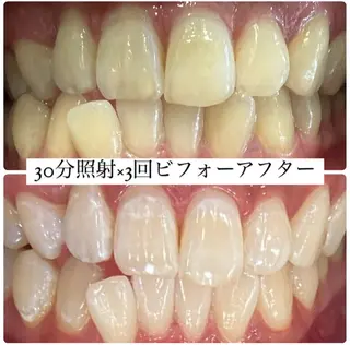 PLATINUM Beauty 横浜店所属・ホワイトニングルーム 横浜店のその他イメージ