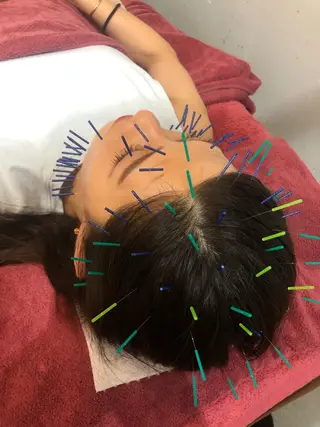 美容鍼灸女性専用 りんご鍼灸治療院のその他イメージ