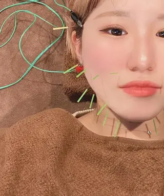 メンズ 美容鍼灸サロン LOMIHARIのエステ・リラクイメージ