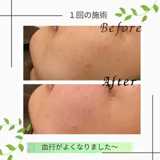 ニキビ改善サロン　縁樹　enju所属・ニキビ専門サロン縁樹 鈴木真樹のエステ・リラクイメージ