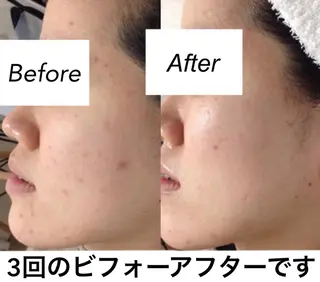 都度払い肌質改善 &脱毛Blancheのエステ・リラクイメージ