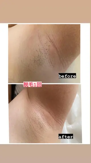 脱毛・エステサロン LuLuNのエステ・リラクイメージ