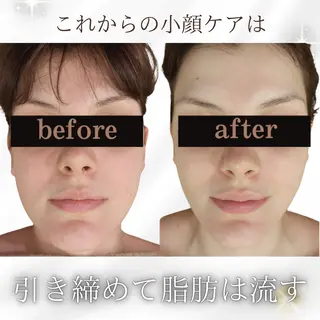 看護師 AYUIのエステ・リラクイメージ