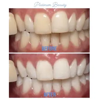 プラティーヌ ボーテ【もものり】のその他イメージ