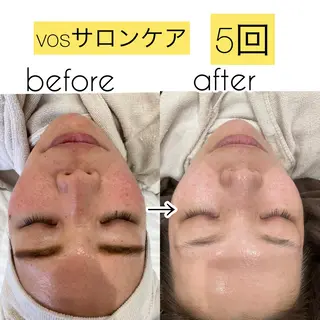 laluna saki...のその他イメージ