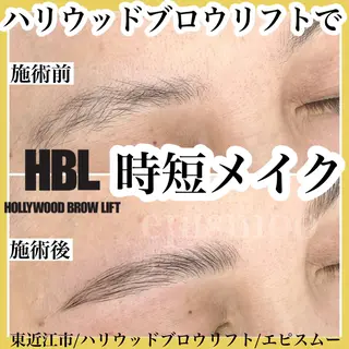 アイブロウ epismoo 脱毛/HBL/毛穴の眉毛・アイブロウイメージ