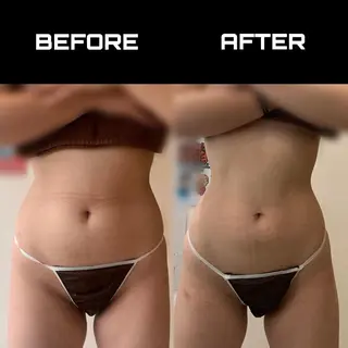 ロング マツエク・マツパ アイブロウ NANIOAFU [本町店]のその他イメージ