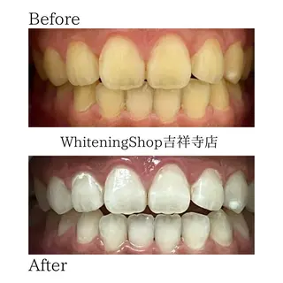 ホワイトニング ショップ吉祥寺店のエステ・リラクイメージ