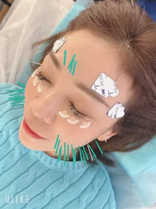 小顔美容鍼専門サロン 渋谷YZのエステ・リラクイメージ