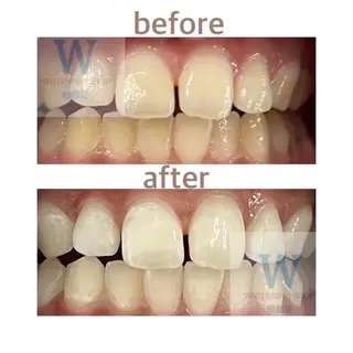 ホワイトニング ショップ船橋店のエステ・リラクイメージ