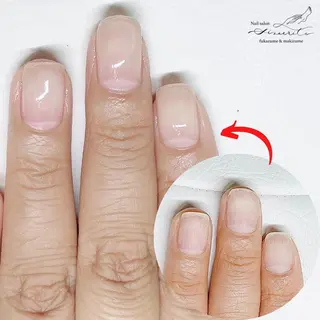 ネイル 深爪・巻き爪 専門サンセリテのネイルデザイン