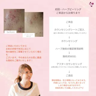 ベラージュ【美背中・ 美尻・フェイシャル】のエステ・リラクイメージ