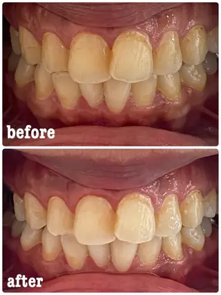 ホワイトニングサロン ラウレアのその他イメージ