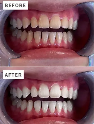 ecxia新宿西口店所属・セルフホワイトニング エクシア新宿西口店のその他イメージ