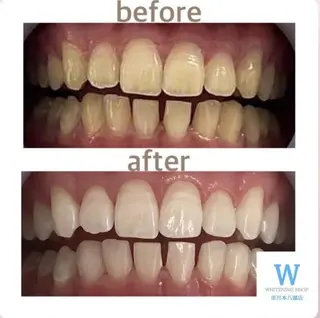 ホワイトニング ショップ本八幡店のエステ・リラクイメージ