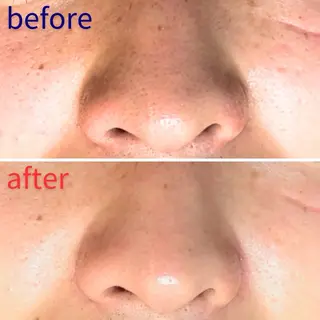 毛穴洗浄特化🫧 オオツカのエステ・リラクイメージ