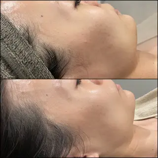 LiZA エステティックサロンのエステ・リラクイメージ