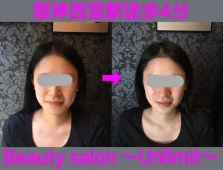 脱毛＆エステサロン【アンリミット】所属・森谷 莉美のエステ・リラクイメージ