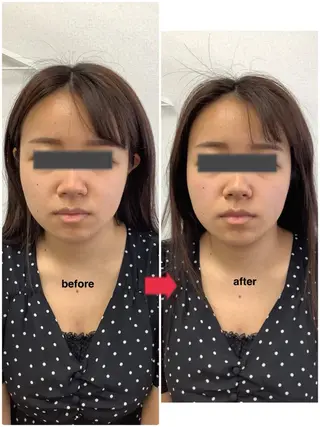 メディカルサロンドオフ所属・ハリサロンドオフ 美容鍼灸×小顔整体のエステ・リラクイメージ