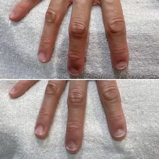 ネイル 痛くないシミ取り 【荻窪】石橋のヘアスタイル