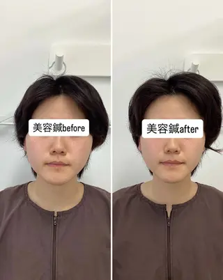 hari salon de off　美容鍼灸×小顔整体【ハリサロンドオフ】所属・美容鍼×小顔整体🤍 ishibashiのエステ・リラクイメージ