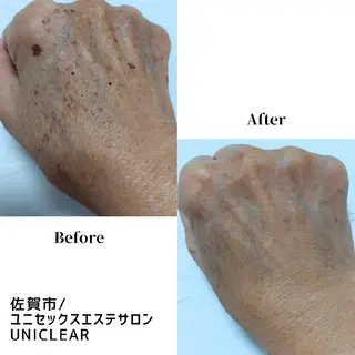 メンズ ユニセックスエステサロンUniclear所属・男女エステ ユニクリアのエステ・リラクイメージ