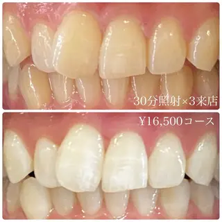 PLATINUM Beauty 横浜店所属・ホワイトニングルーム 横浜店のその他イメージ