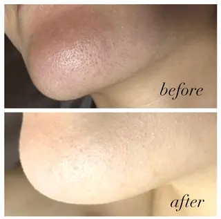 河野 ひとみのエステ・リラクイメージ