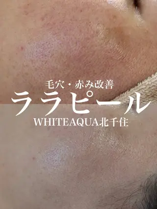 WHITE AQUA 北千住店のエステ・リラクイメージ
