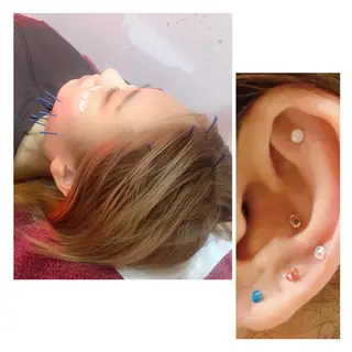 美容鍼灸女性専用 りんご鍼灸治療院のその他イメージ