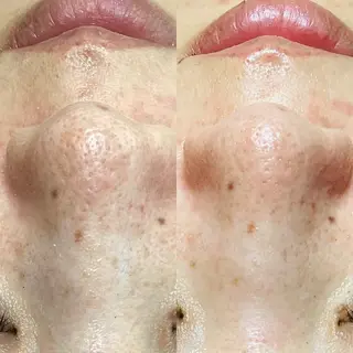 Rifuro毛穴ケア &よもぎ蒸しサロンのエステ・リラクイメージ