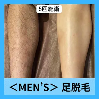 メンズ 秋山 瑞月のエステ・リラクイメージ