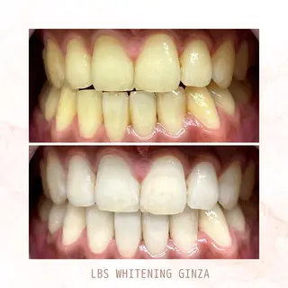 メンズ LBSホワイトニング 銀座店💎店長浦和のその他イメージ