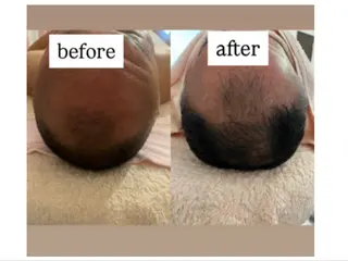 salon＿drop所属・salon dropのエステ・リラクイメージ