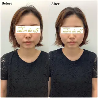 メディカルサロンドオフ所属・ハリサロンドオフ 美容鍼灸×小顔整体のエステ・リラクイメージ