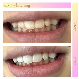 セルフホワイトニング エクシア東上野店のその他イメージ