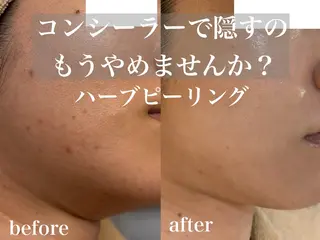 WHITE AQUA 北千住店のエステ・リラクイメージ