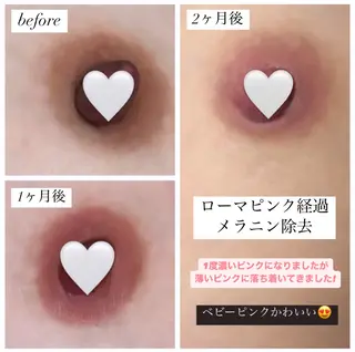 強力痩身専門サロン /ローマピンク導入店のその他イメージ