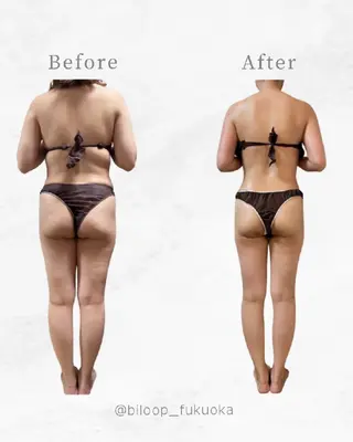 biloop所属・《痩身×疲労改善》 BILOOPのエステ・リラクイメージ