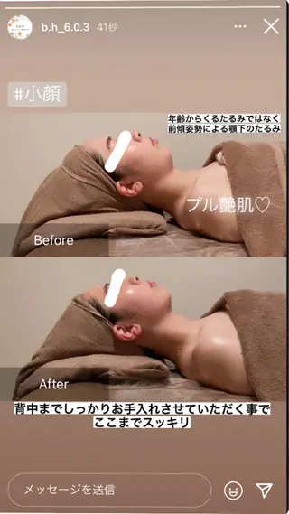 B&H所属・頭痛•肩こり専門/ 眉サロンB&H心斎橋のエステ・リラクイメージ