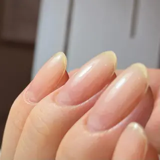 ネイル 自爪育成・巻き爪 補正講師　津蔵のネイルデザイン