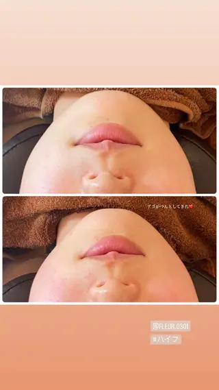 FLEUR大阪・整体 ・ハイフ・痩身・小顔のエステ・リラクイメージ