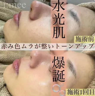 森 叶愛のエステ・リラクイメージ