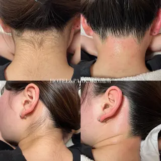 HOTEL&PARK Mikuワックス脱毛のエステ・リラクイメージ